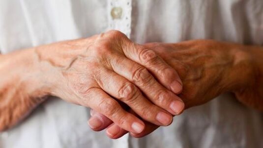 rheumatoid arthritis bilang sanhi ng pananakit ng mga kasukasuan ng mga daliri