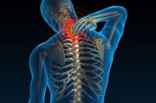 Ang cervical osteochondrosis ay humahantong sa pagkahilo sa leeg