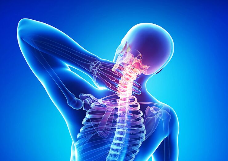 Ang spinal osteochondrosis ay isang sakit na nakakaapekto sa articular cartilage at vertebrae.